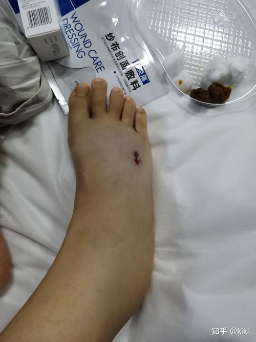 今晚澳门9点35分开什么生肖和男子在湖边被蛇咬伤与男子在湖边被蛇咬伤视频